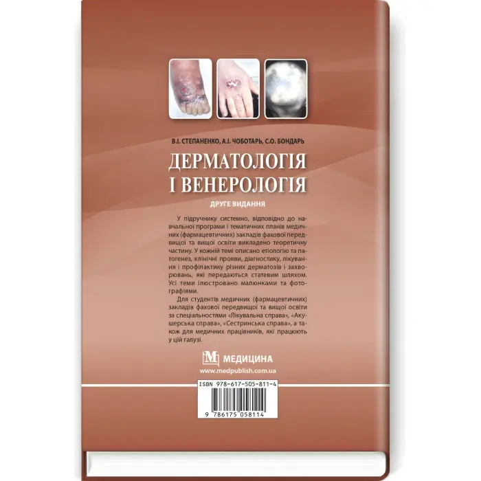 Дерматологія і венерологія: підручник / В.І. Степаненко, А.І. Чоботарь, С.О. Бондарь та ін. — 2-е видання