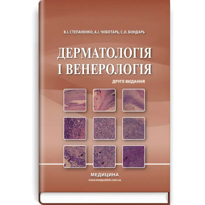 Дерматологія і венерологія: підручник / В.І. Степаненко, А.І. Чоботарь, С.О. Бондарь та ін. — 2-е видання