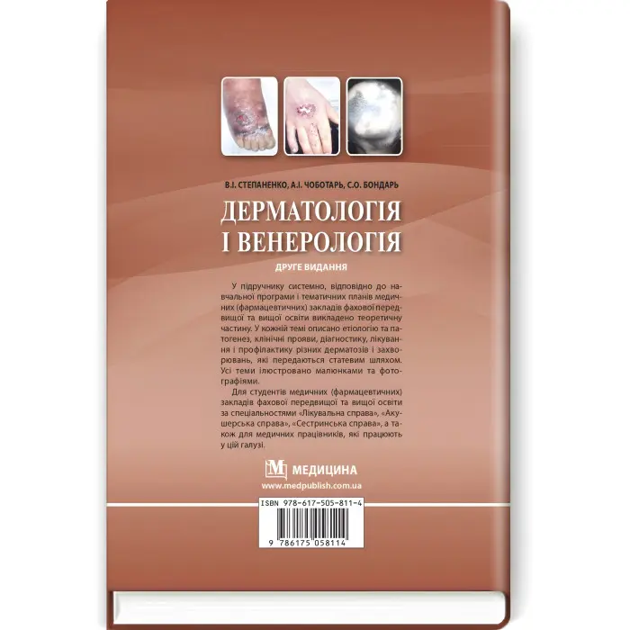 Дерматологія і венерологія: підручник / В.І. Степаненко, А.І. Чоботарь, С.О. Бондарь та ін. — 2-е видання
